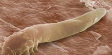 <ul><li><p>burrowing mite</p></li><li><p>common comensal of all animals</p></li><li><p>hosts: mammals have their own host adapted species, most commonly the dog</p></li><li><p>predilection site: hair follicles, sebaceous glands</p></li><li><p>demodectic or follicular mange</p></li><li><p>morphology: small, elongated cigar shaped</p></li><li><p>not contagious</p></li><li><p>transmission: mom to baby during suckling</p></li><li><p>diagnosis: deep skin scrapings</p></li><li><p>treatment: rare, if needed antibiotics for secondary bacterial infection or steroids for inflammation </p></li></ul>