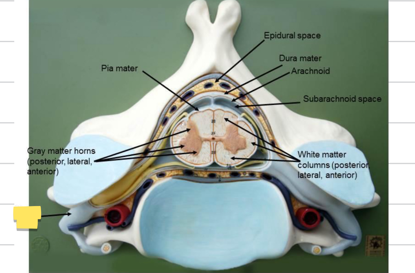 <p>Name this spinal cord part</p>