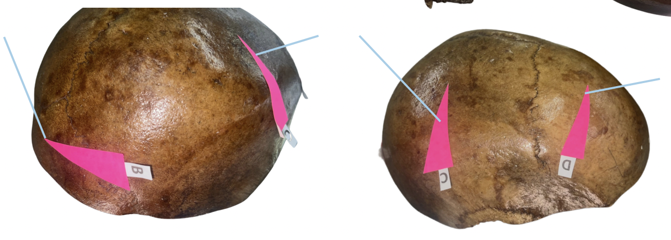 <p>Identify the bone structure labeled as C.</p>