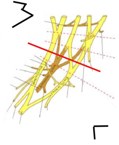 <p>What is this division BELOW the probe?</p>