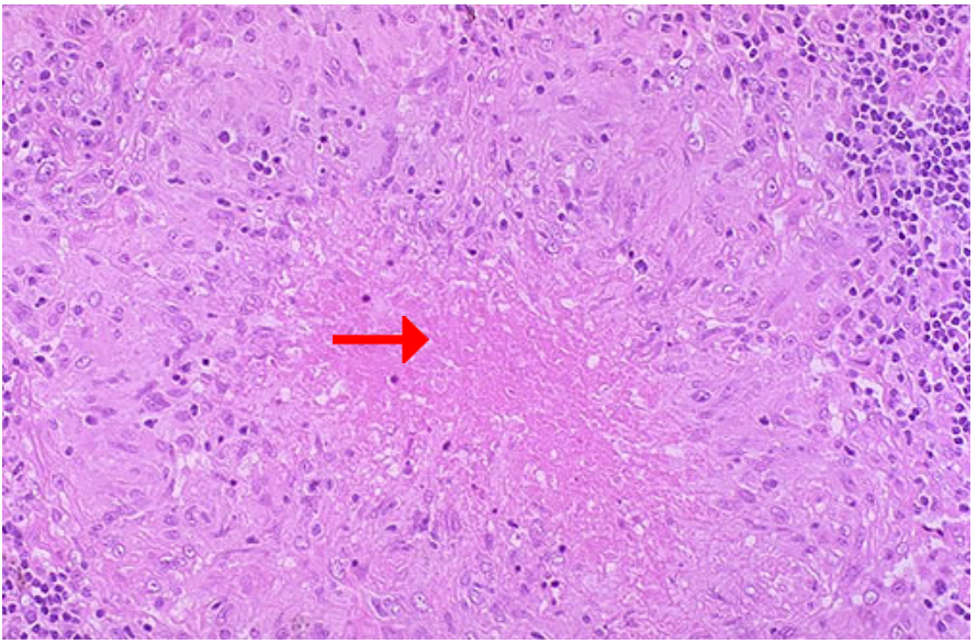<ol><li><p>Identify cellular process</p></li><li><p>Identify pointer area</p></li></ol><p></p>