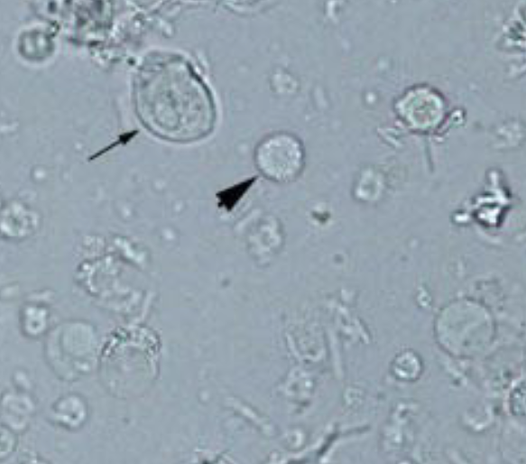 <p><span style="color: #000000">What is the thick black arrow pointing to?</span></p><p><span style="color: #000000">What is the thin black arrow pointing to?</span></p><p><span style="color: #000000">What is the normal range of your answer above?</span></p>