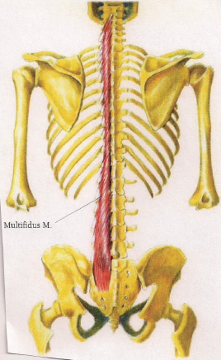 <p>what are the actions and innervations for the multifidus muscles?</p>