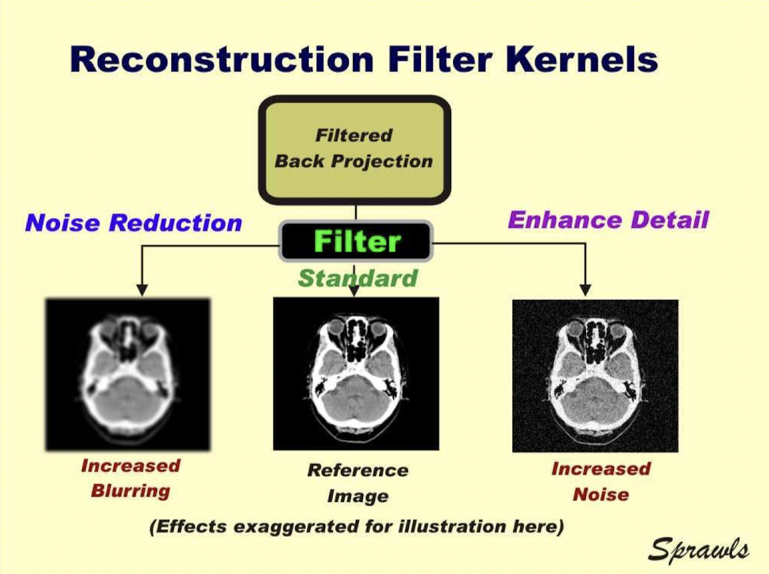 <p>Dec artifacts but dec spatial resol</p>