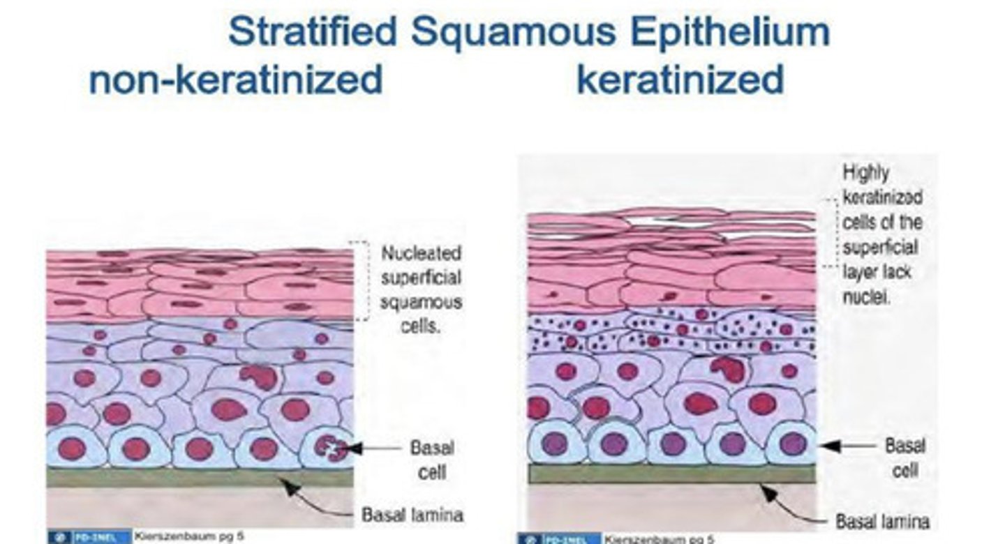 <p>Stratified squamous epithelium</p><p>It can be:</p><p>1. Keratinized - having a layer of dead cells with no nuclei</p><p>2. Parakeratinized - dead and dying cells with no nuclei</p><p>3. Nonkeratinized - cells that are alive (has nuclei)</p>