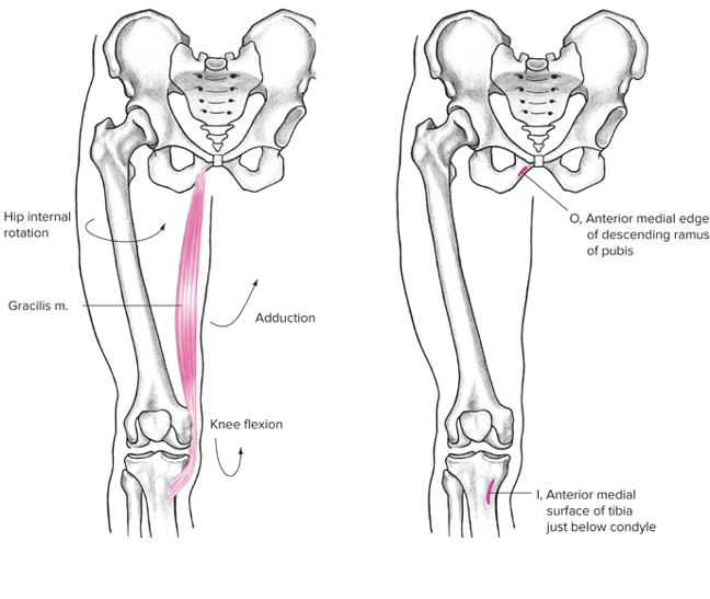 Most medial 

Origin: Pubis/ anterior medial edge of descending ramus of pubis 

Insertion: Tibia (biarticular, anterior medial surface of tibia just below condyle)

Action at hip: Internal rotation 

Action at knee: flexion, adduction 