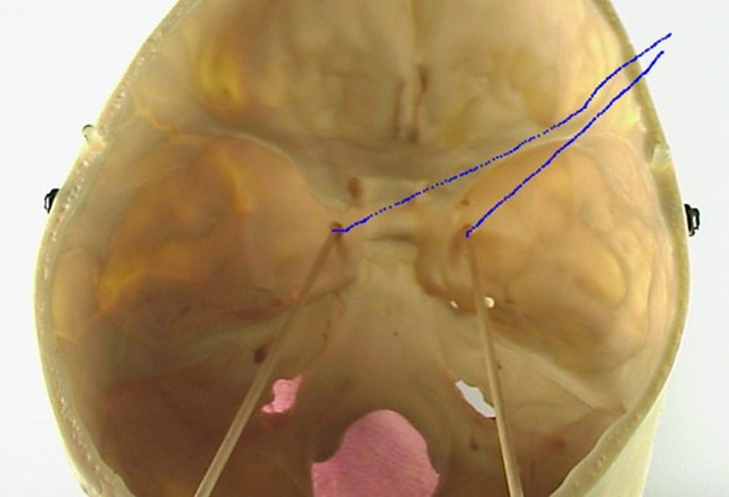 <p>hole under superior orbital fissure</p>
