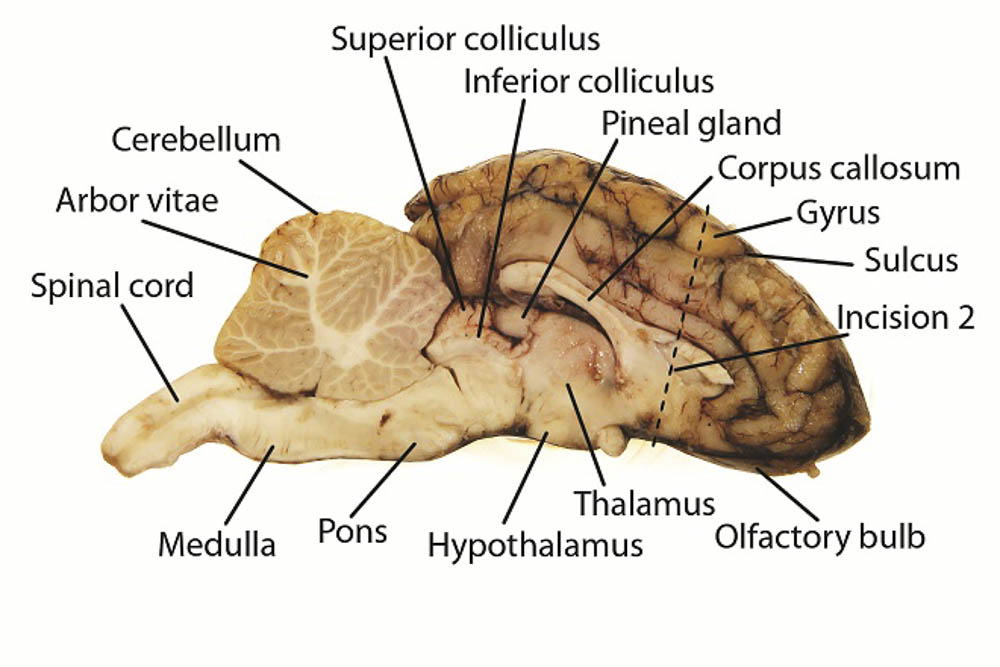 <p>“bridge that links medulla oblongata to thalamus </p>