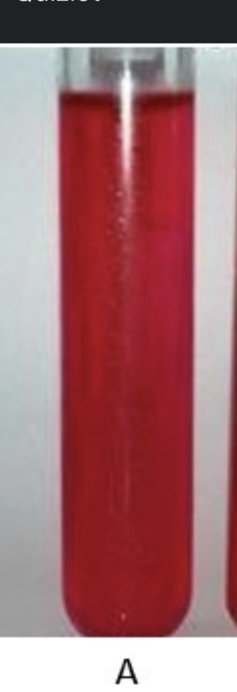 <p>What does it mean if phenol Red is red </p>