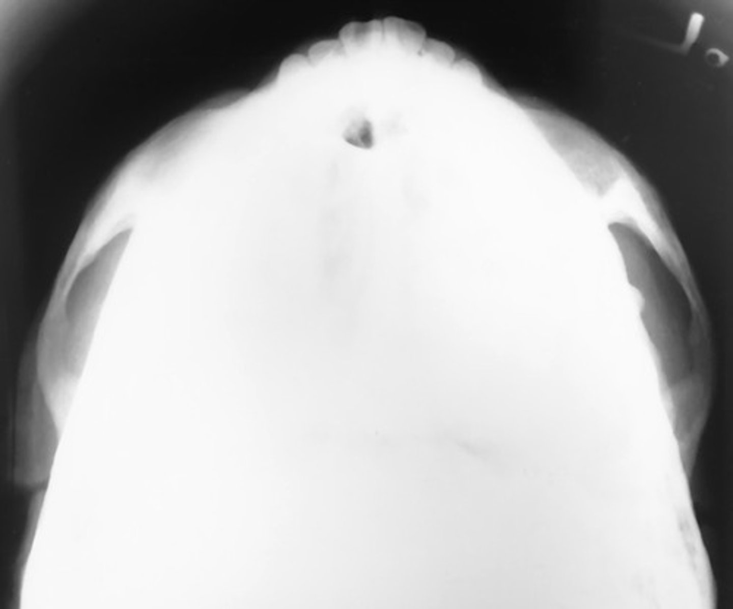 <p>What position/projection?</p>