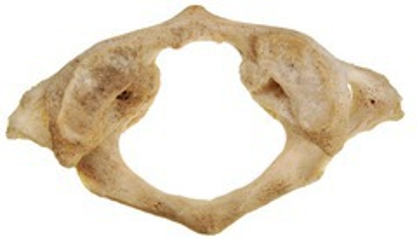 <p>name the bone</p>