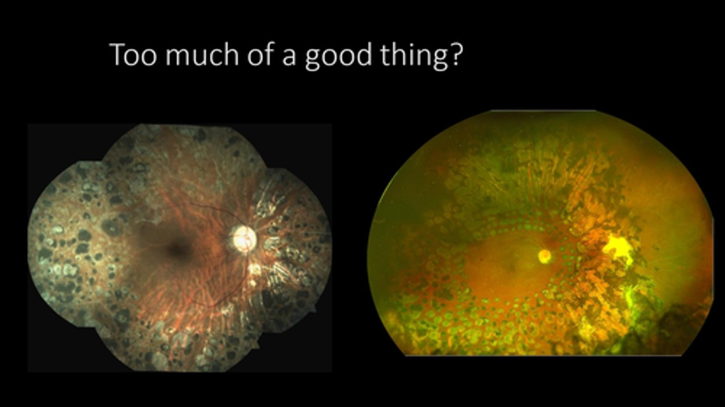 <p>What is the referral and f/u timeline for neovascular glaucoma treated / iris neo?</p>