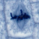 <ol><li><p><span>Chromosomes (each with 2 chromatids) are moved by spindle fibres and align on the metaphase plate </span></p></li><li><p><span>Become attached to spindle by their centromere </span></p></li><li><p><span>At metaphase checkpoint, cell checks all chromosomes are attached to the spindle before mitosis can continue</span></p></li></ol><p></p>