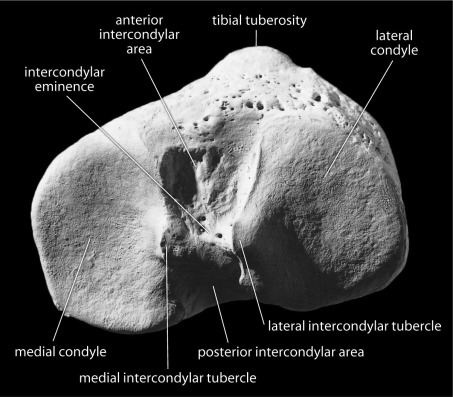 <p>morer concave and oval shaped end, superior and medial. straight edge along intercondylar eminence</p>
