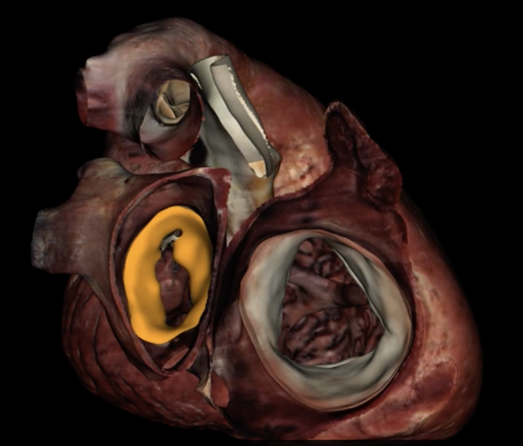 <p>What is highlighted in orange?</p>