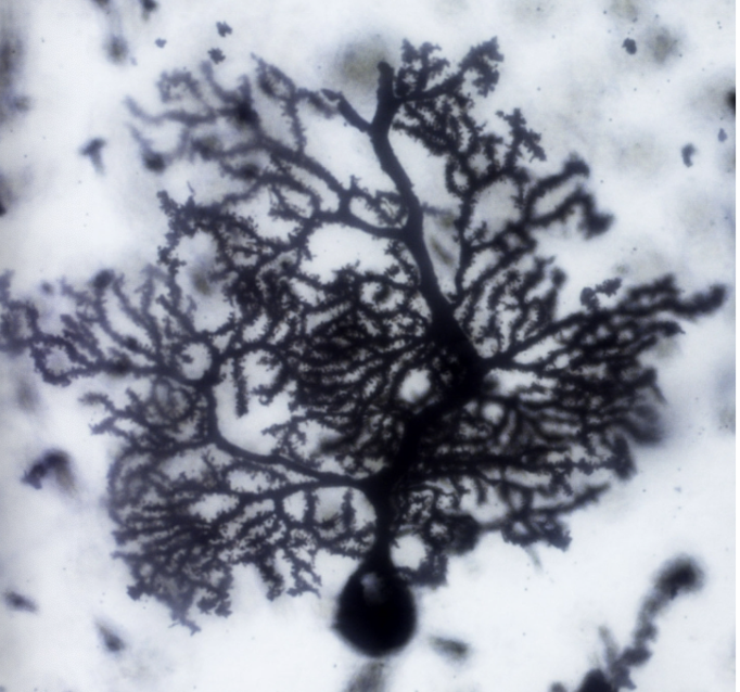 <p>The only OUTPUT of all motor coordination in the cerebellum!</p><p>Inhibit cells of deep cerebellar nuclei!</p>