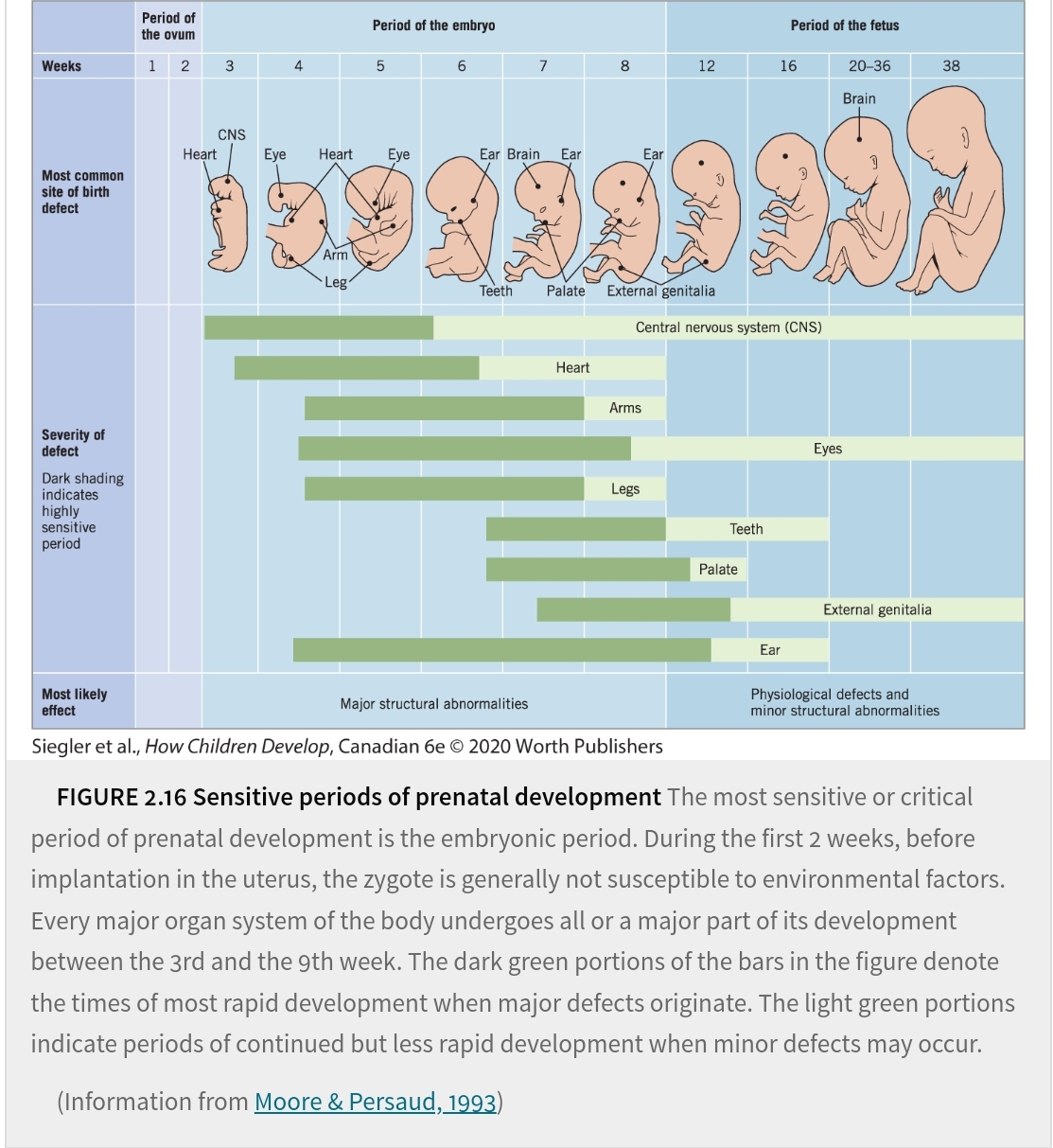 <ul><li><p>Thalidomide → cause limb devel (Second week)</p></li><li><p>dose -response relation → amount of exposure to teratogens</p></li><li><p>fetal programing →ajust to level Of nutrition deficiency doesn't rest</p></li><li><p>genetic susceptibility → predisposed</p></li></ul>