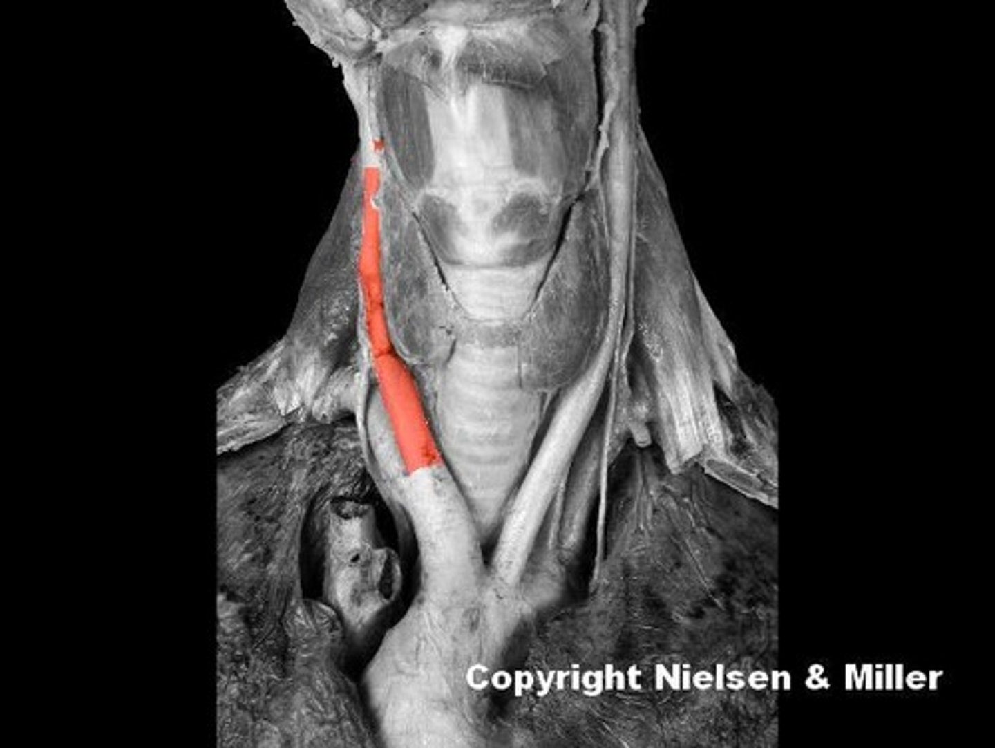 <p>Identify the highlighted vessel</p>