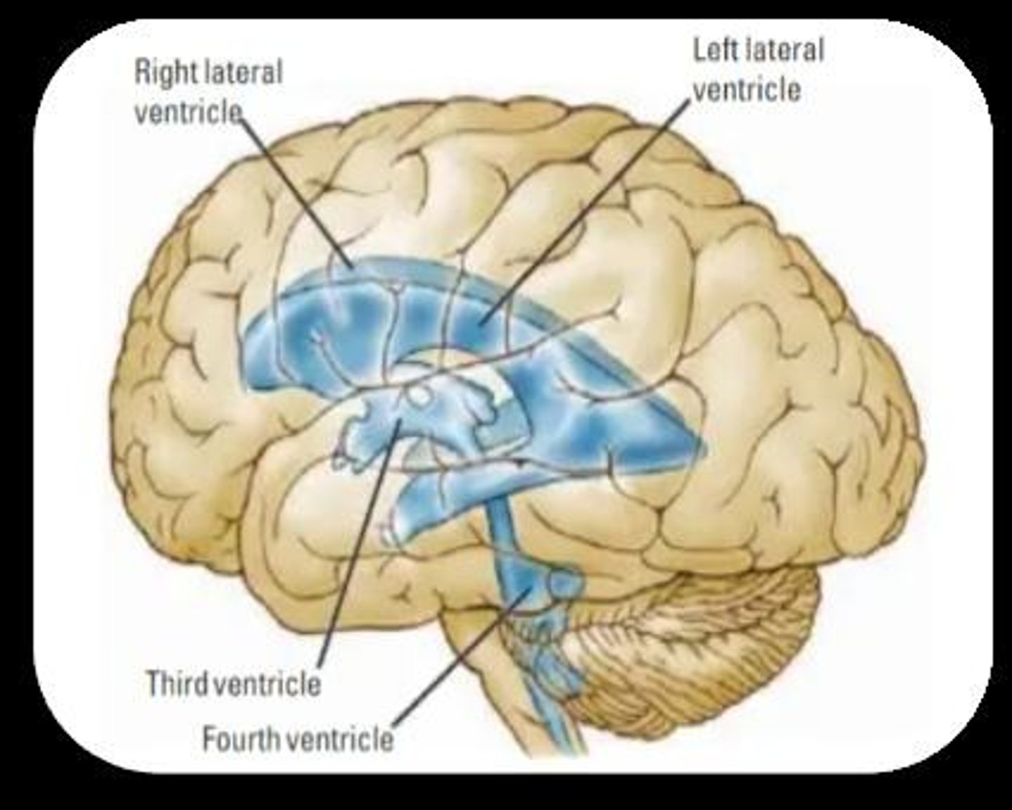 <p>It shows skull as white, grey and white matter as similar, and ventricles as dark.</p>