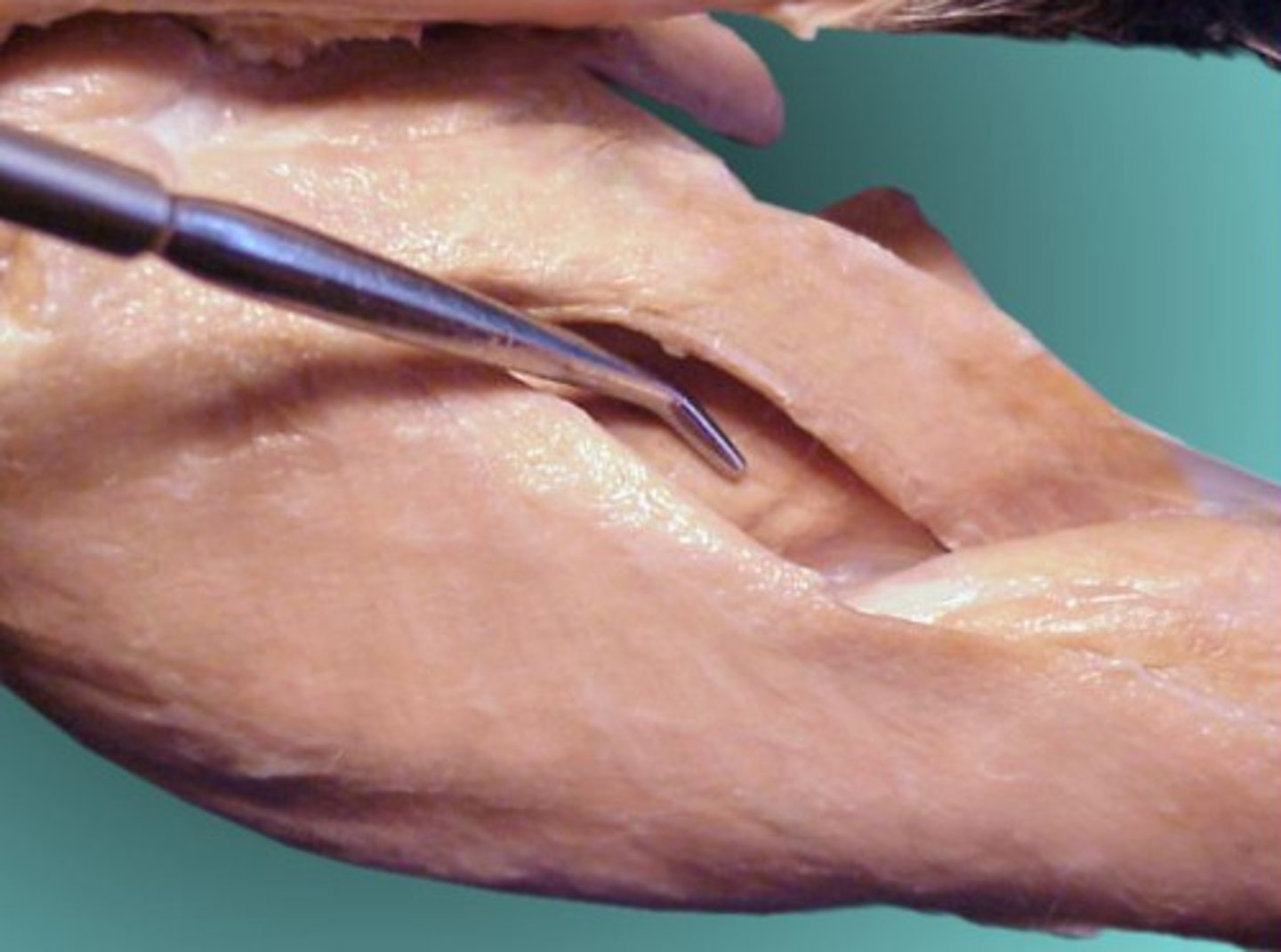 <p>Identify what the probe is pointing to</p>