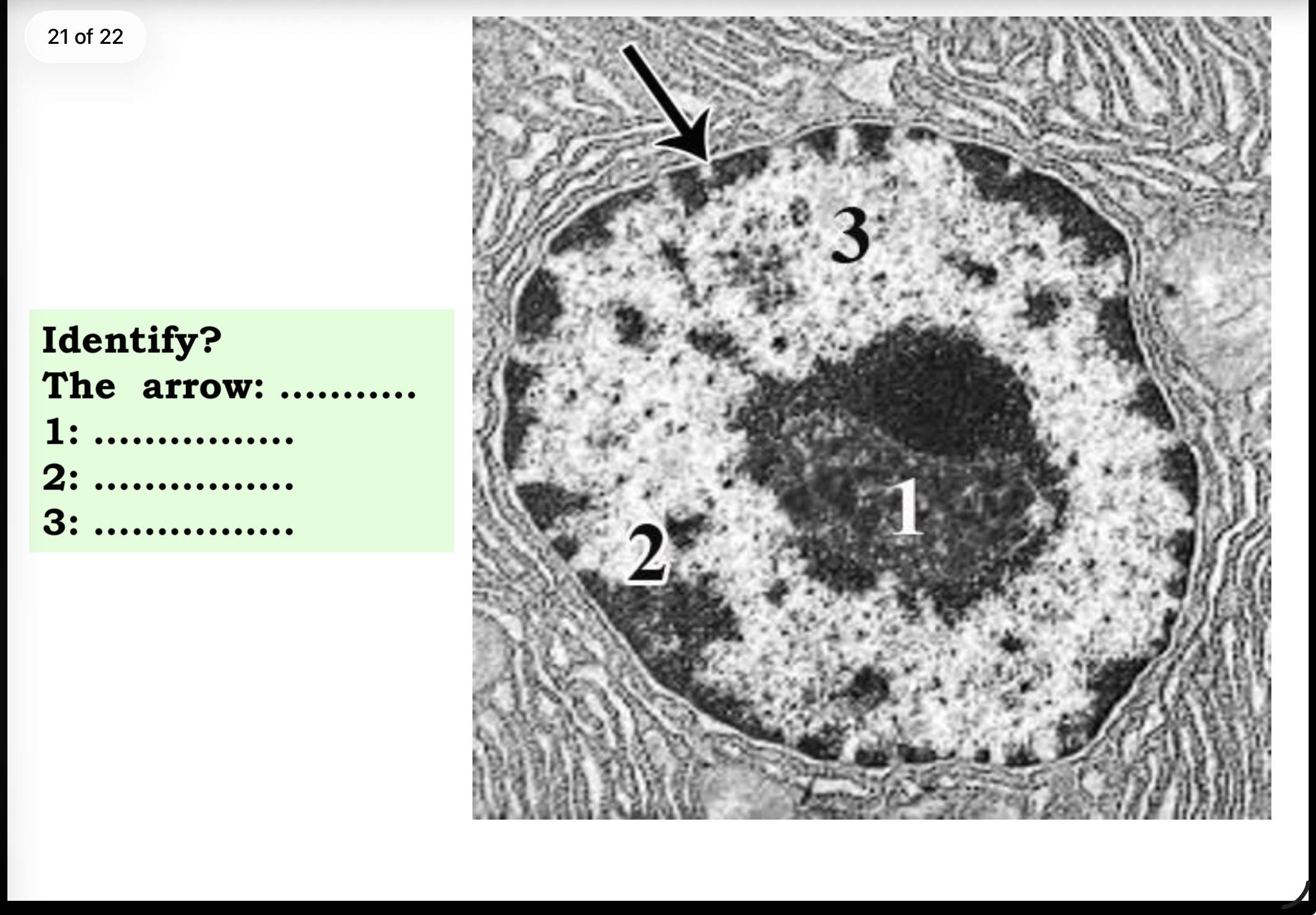 <p>Answer the questions in these following pictures</p>