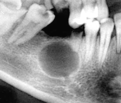 <p>What is this dental anomaly?</p>