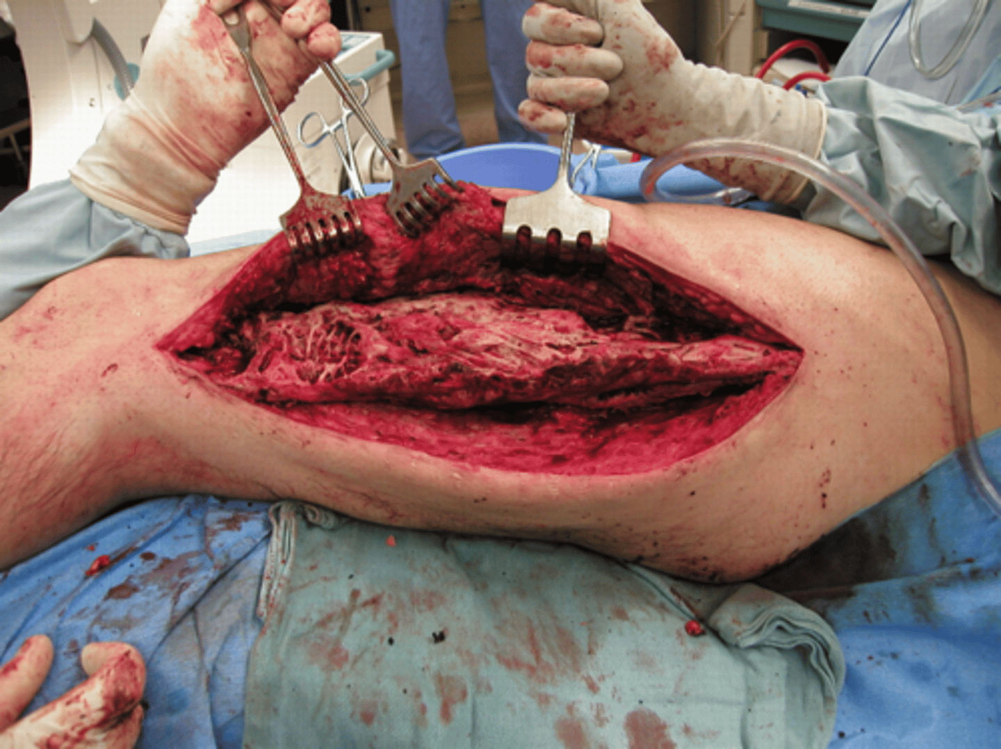 <p>Name the pathology</p>