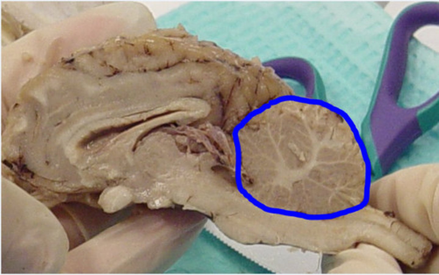 <p>-Occupies posterior cranial fossa</p><p>-Separated from cerebrum by transverse cerebral fissure</p>