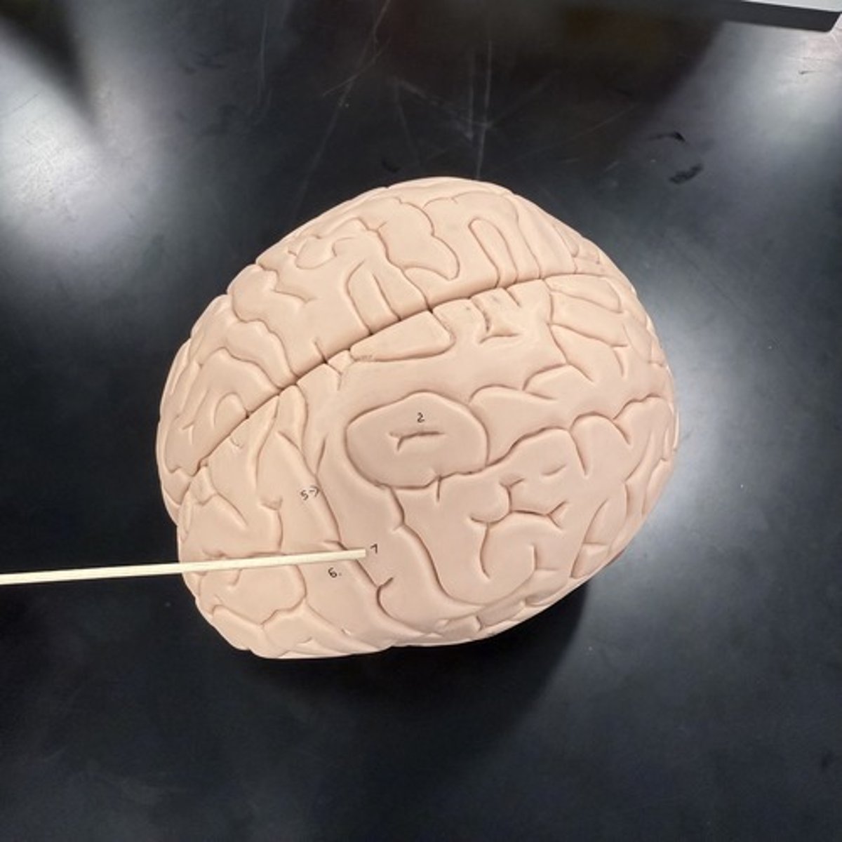 <p>What is this ridge (fold)?</p>