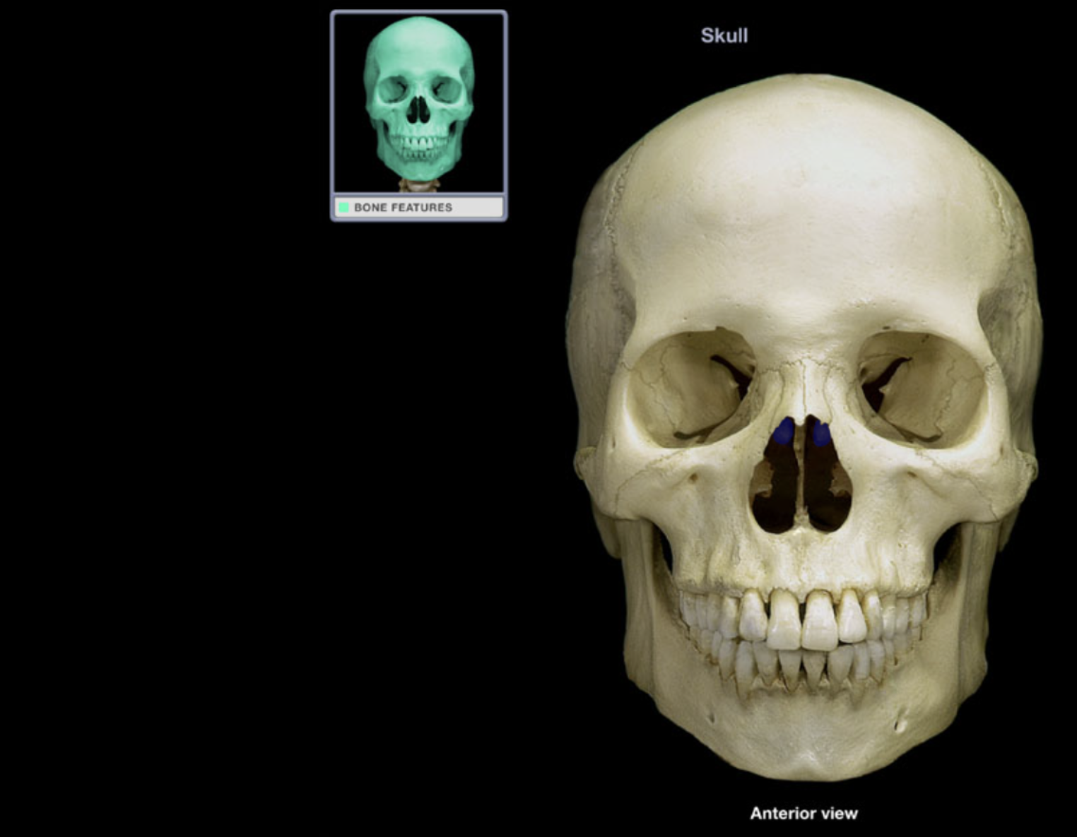 <p>Middle nasal concha</p>