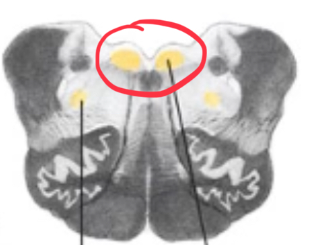 <p>originate just deep to the dorsal surface of the open medulla</p>