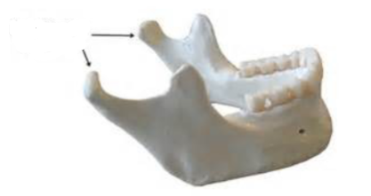 <p>Which mandibular marking is this? (2)</p>