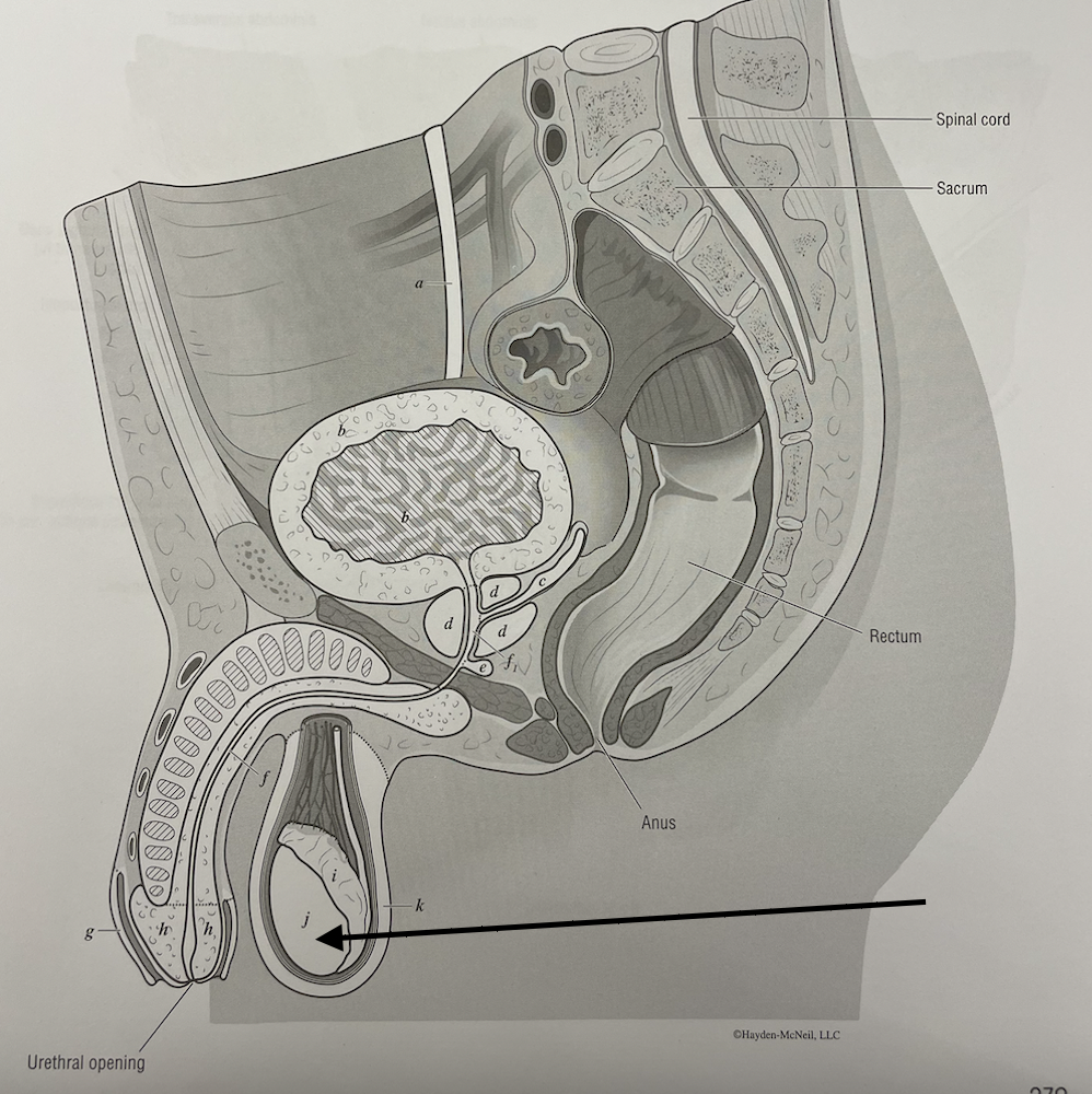 <p>what structure is this</p>