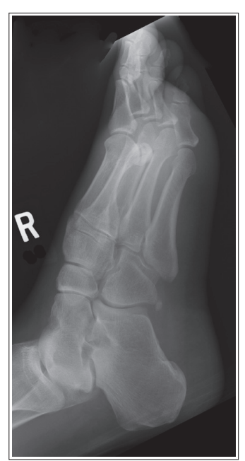 <p>What is the issue with this oblique foot?&nbsp;</p>