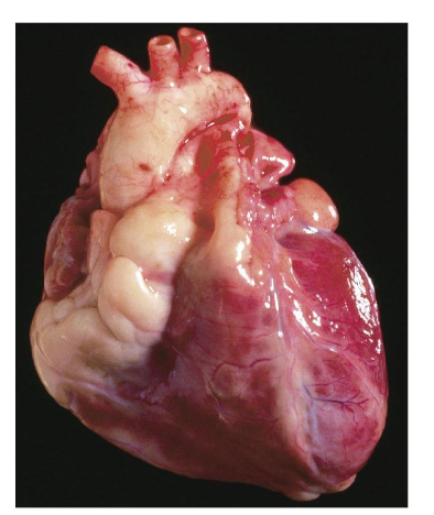 <ul><li><p><span><span>The heart is made of cardiac muscle tissue called myocardium</span></span></p></li><li><p>Muscle tissue is  different from skeletal muscle → it contracts and relaxes involuntarily (automatic/autonomic)</p></li><li><p><span><span>Gap junctions → Help the heart to beat properly, and beat very quickly, contracting as a full unit</span></span></p></li><li><p><span><span>Metabolism → Very high oxidative capacity</span></span></p></li><li><p><span><span>35% compared to 5% in skeletal muscles&nbsp;&nbsp;</span></span></p></li><li><p><span><span>Fatigue-resistant → The heart will beat about 3 billion times over a lifetime&nbsp;</span></span></p></li><li><p>Skeletal muscles less fatigue resistant (can only run so far until the muscles give out, can’t lift as much weight as before etc)</p></li></ul><p></p>
