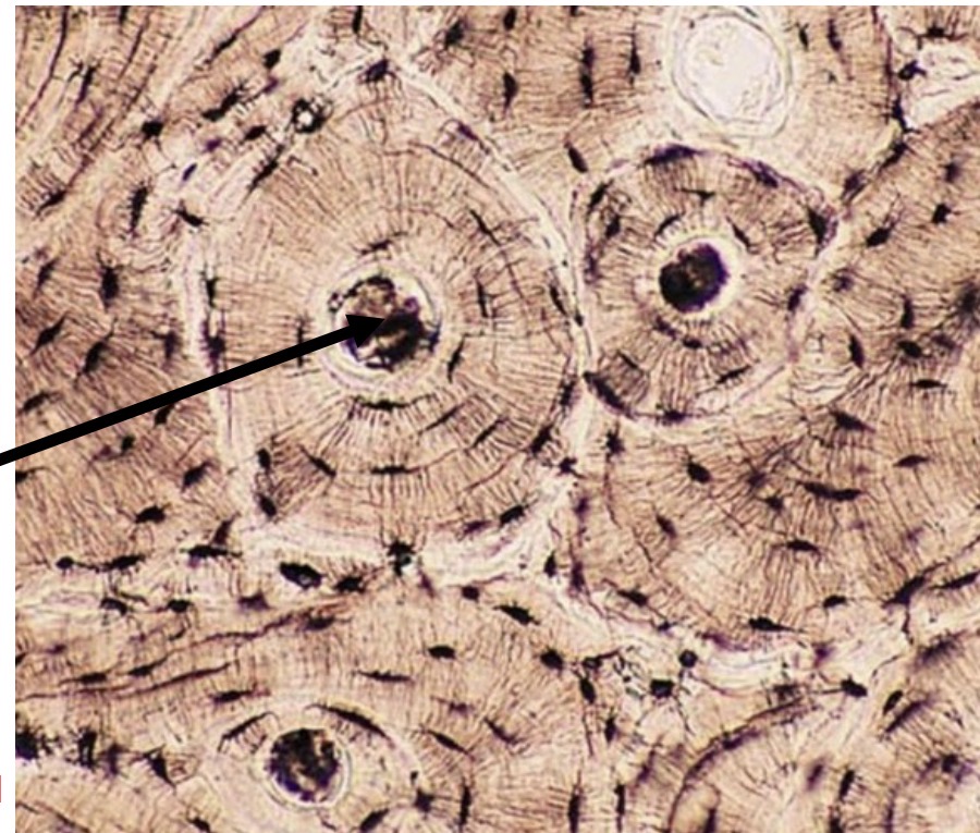 <p>Identify the type of tissue and the<br>structure at the arrow</p>