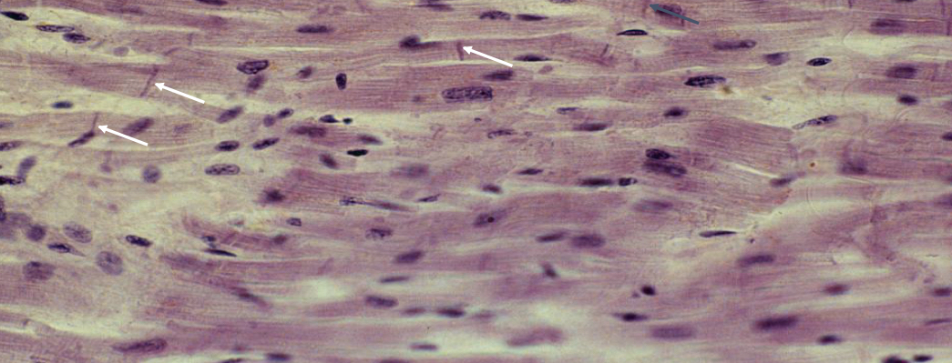 What is the picture showing? What are the arrows pointing at? 