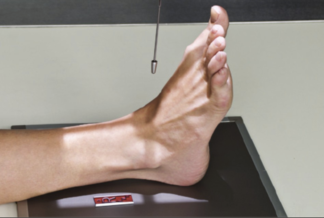 <p>Fine FS, 100cm</p><p>60kVp,&nbsp;4mAs</p><p>Straight tube</p><p>CR: between and at level of malleoli</p>