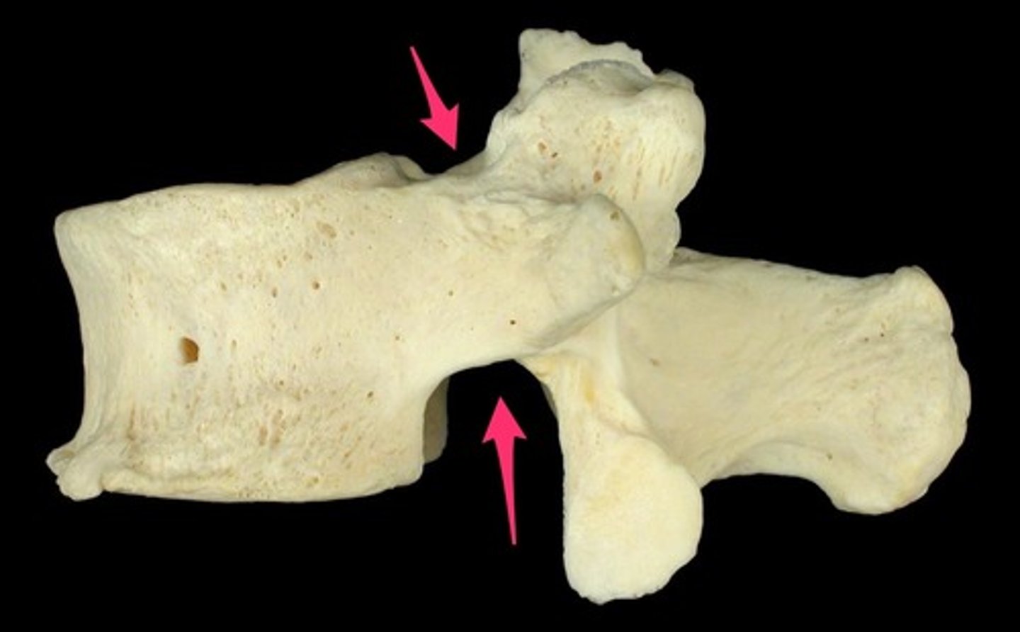 <p>vertebral notches</p>