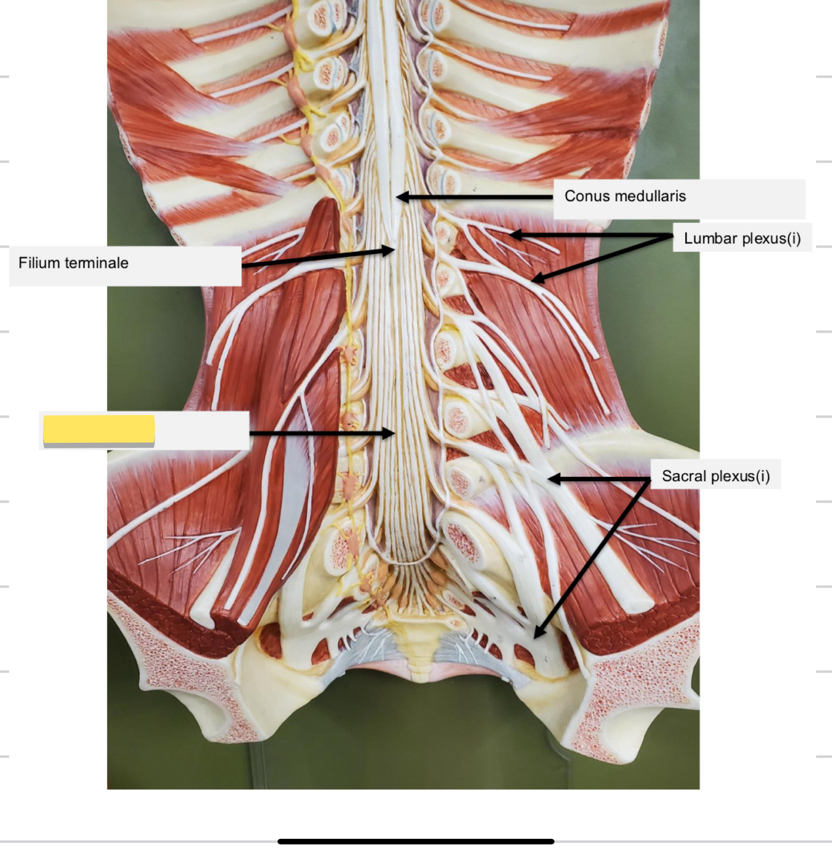 <p>Name this part</p>