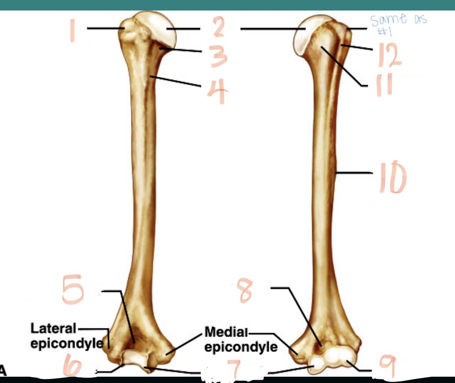 <p>Greater tubercle</p>