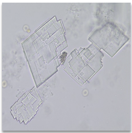 <ul><li><p class=""><strong>Appearance:</strong> Clear, flat, rectangular plates with a notched corner</p></li><li><p class=""><strong>Urine type:</strong> Acidic</p></li><li><p class=""><strong>Solubility:</strong> Soluble in chloroform, ether</p></li><li><p class=""><strong>Polarized light:</strong> Birefringent (brightly colored under polarization)</p></li><li><p class=""><strong>Associated conditions:</strong></p><ul><li><p class="">Nephritis, nephrotic syndrome (excess tissue breakdown)</p></li><li><p class="">Chyluria (obstructed lymph drainage from tumors, filariasis, lymph node enlargement)</p></li></ul></li><li><p class=""><strong>Additional notes:</strong></p><ul><li><p class="">Rare in urine; lipids typically remain as droplets</p></li><li><p class="">Refrigeration may artifactually cause appearance</p></li></ul></li></ul><p></p>