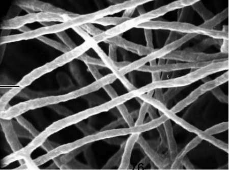 <p>long filamentous fungi </p>