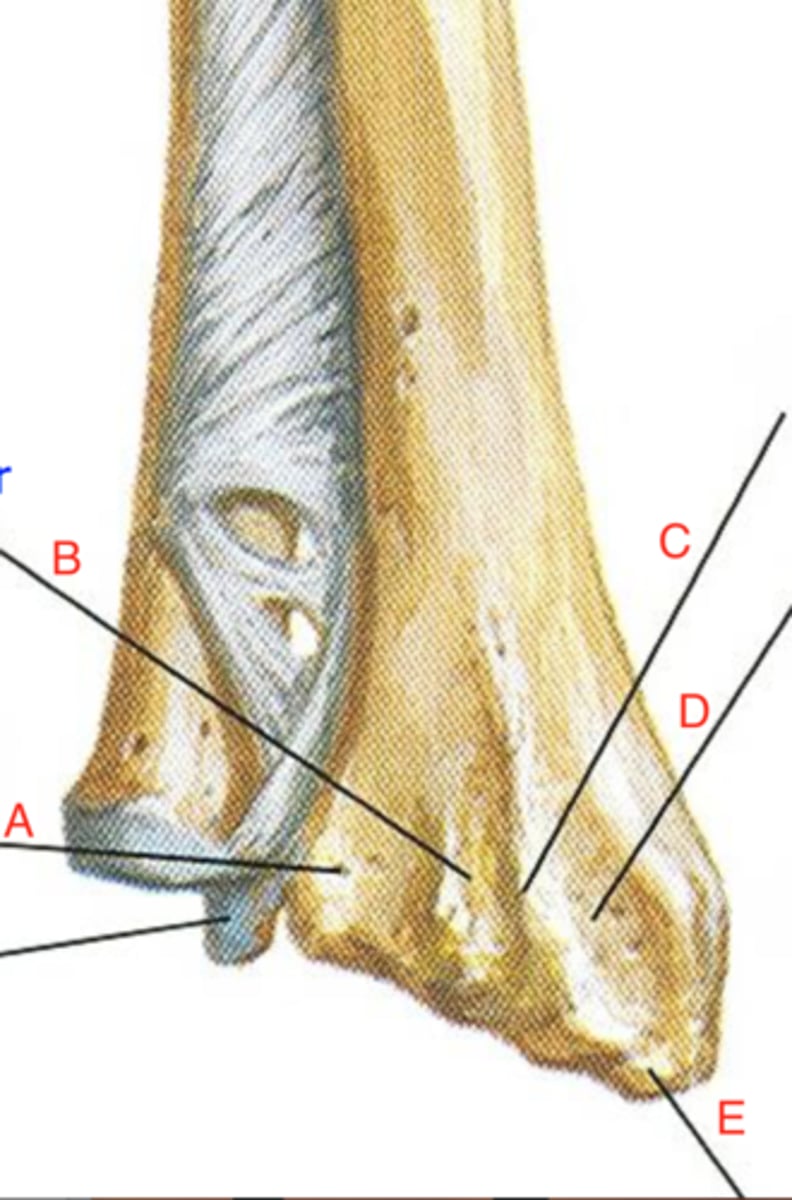 <p>D</p>