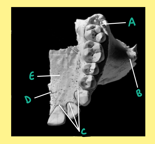 <p><u>Name the following</u>:</p><ul><li><p>Bone?</p></li><li><p>Side?</p></li><li><p>View?</p></li><li><p>B?</p></li></ul><p></p>