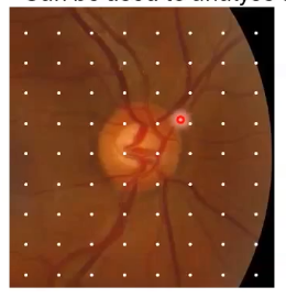 <p>OCT scans of the ONH (1): optic disc cube</p>