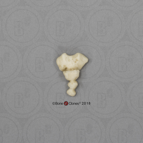 <p>Identify the part of the vertebra and explain what diagnostic features helped you reach your conclusion.</p>
