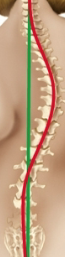 <p>Abnormal curvatures</p>