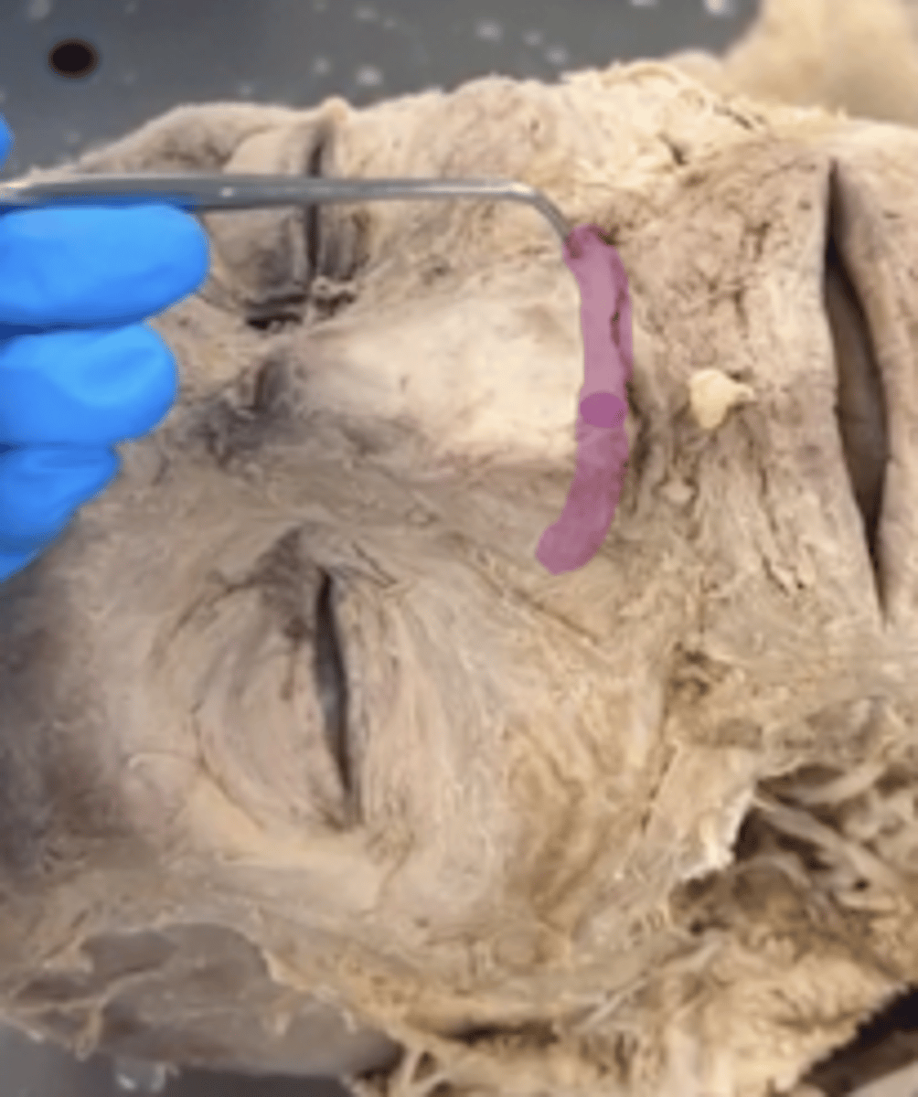 <p>Name the muscle.</p>