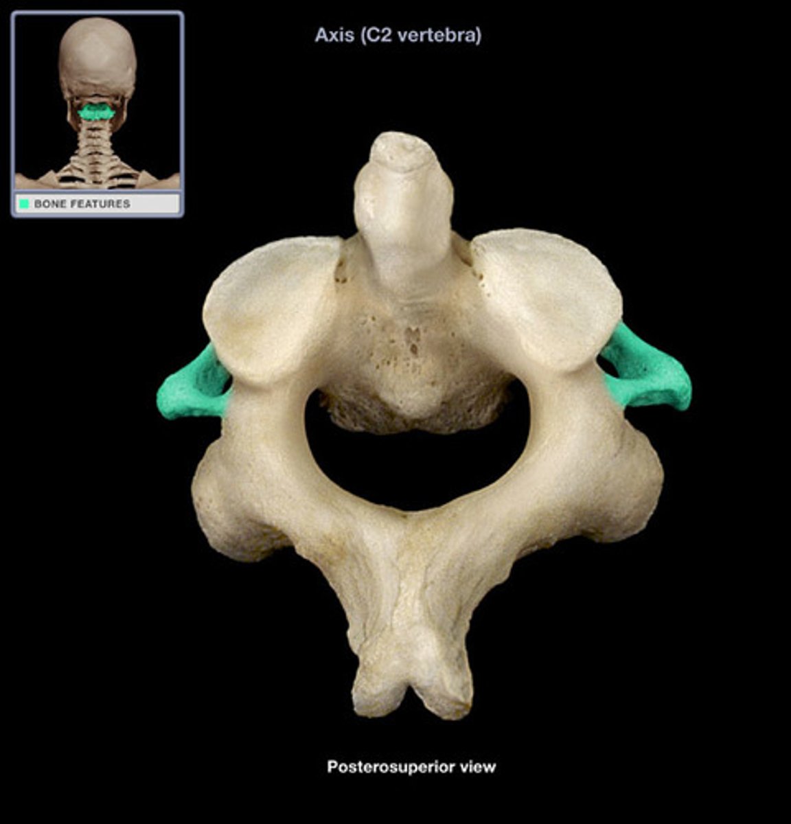 <p>(what vertebra and what structure is highlighted)</p>